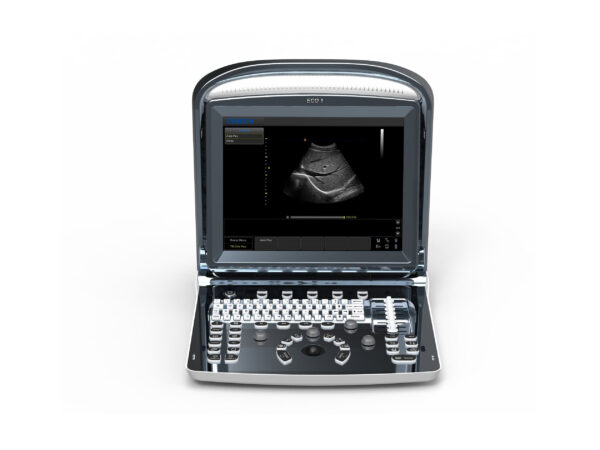 MÁY SIÊU ÂM XÁCH TAY ECO 1  -  HÃNG: CHISON MEDICAL