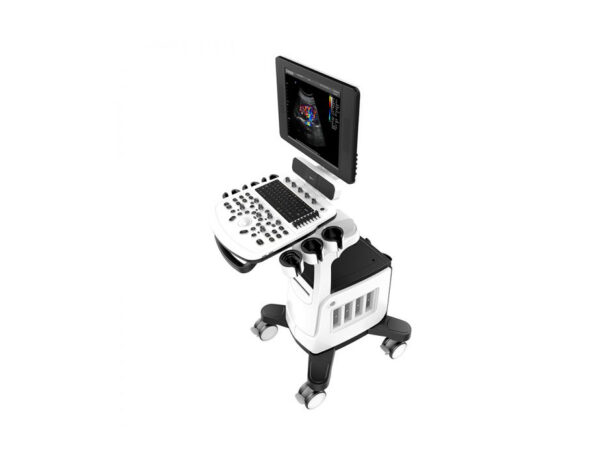 MÁY SIÊU ÂM 2D QBIT5 - CHISON medical